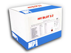 HIV 2.2 BLOT